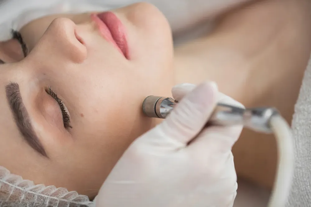 Microdermabrasion à VERSAILLES
